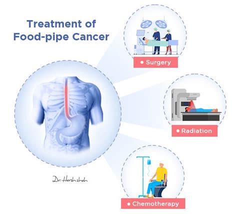 esophageal cancer therapy